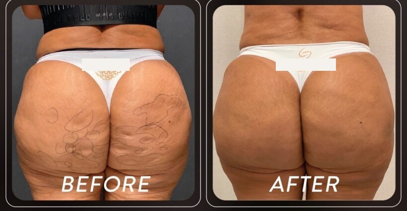 Before and after — Patient 02 · Post-treatment