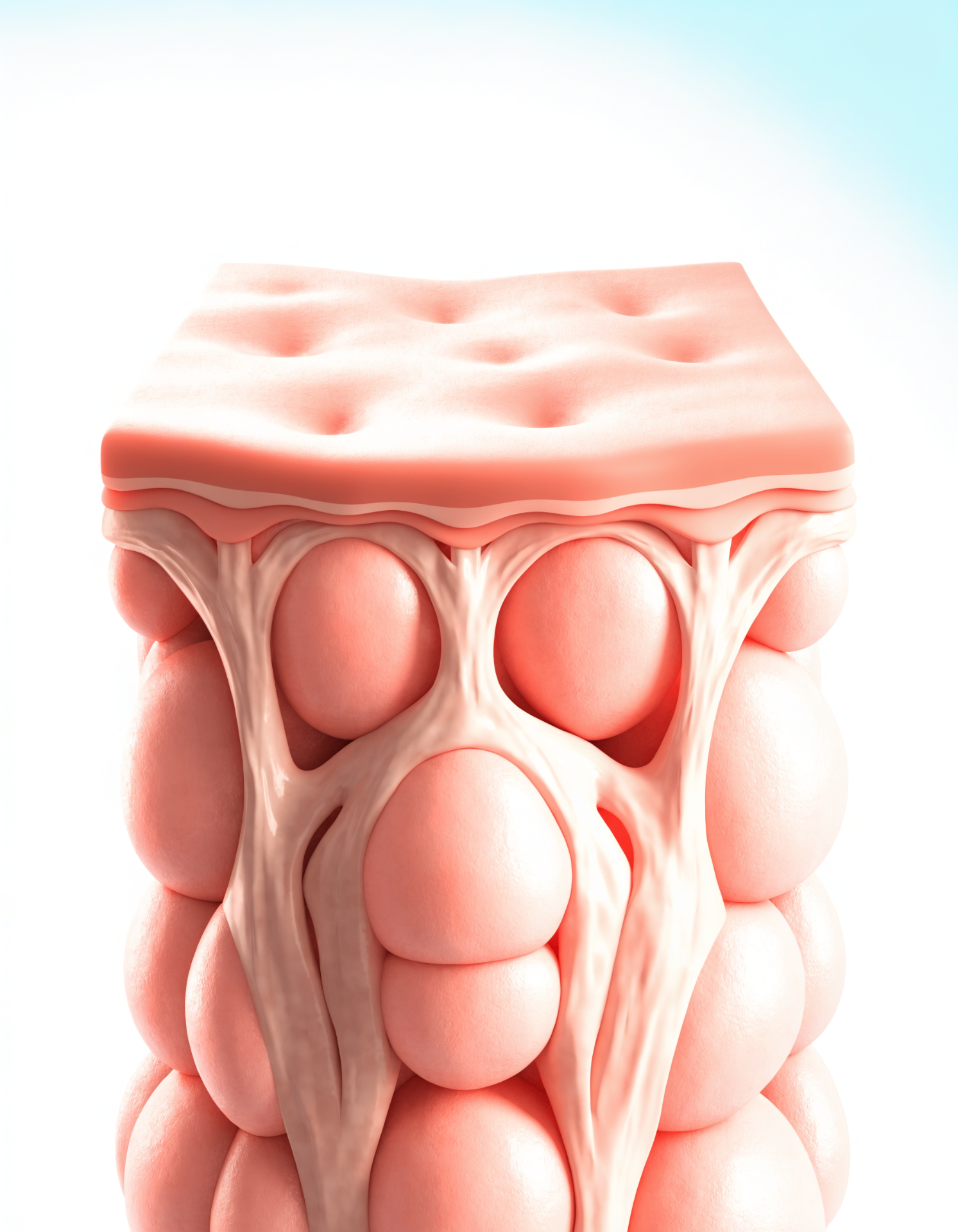 Medical illustration showing fibrous bands pulling the skin downward and creating visible cellulite dimpling