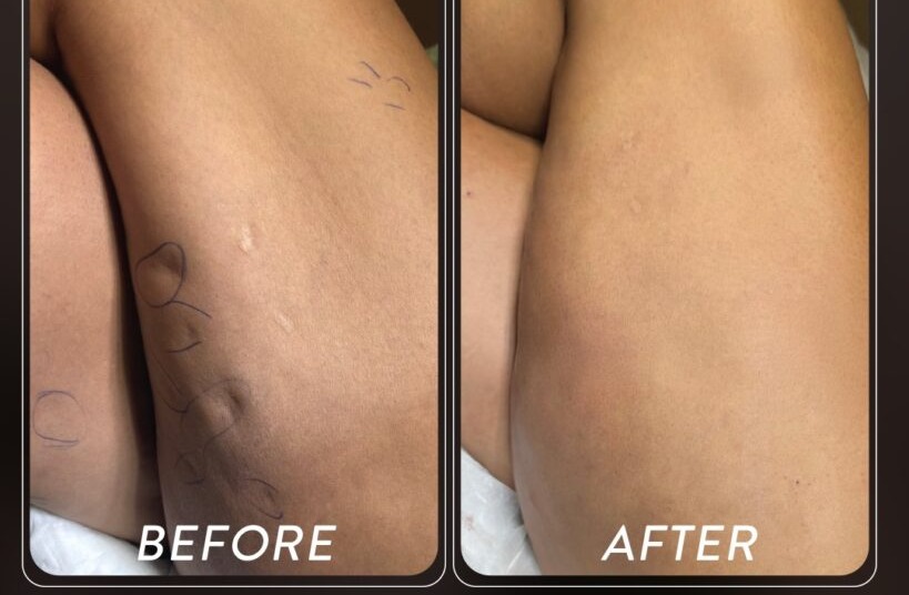 Before and after — Patient 04 · Post-treatment