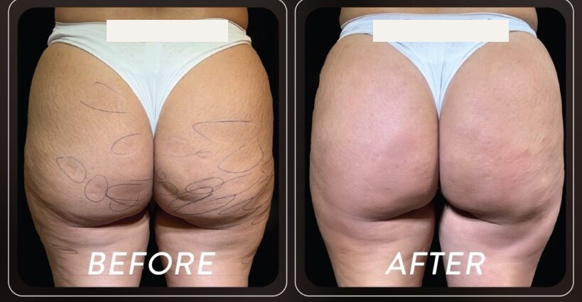 Before and after — Patient 03 · Post-treatment